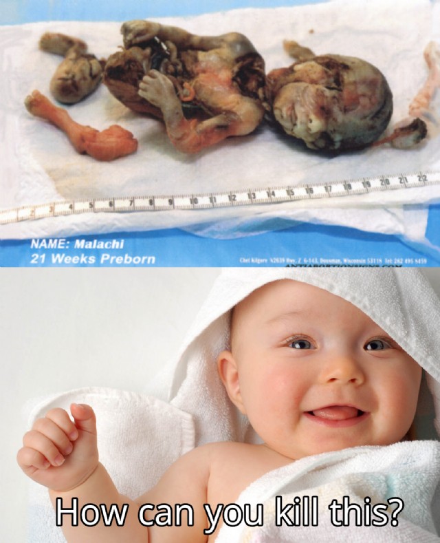 Voice Of The Aborted