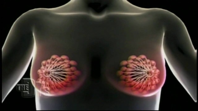I Saw Flowers In Your Breasts