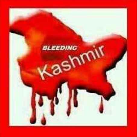 Kashmir Is Bleeding...