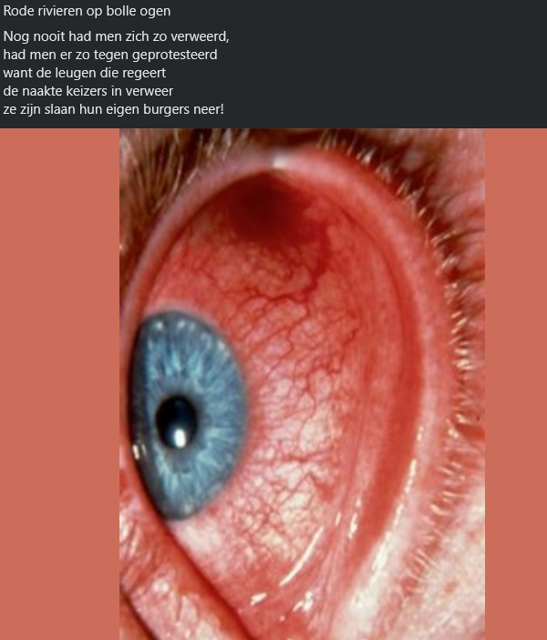 Rode Rivieren Op Bolle Ogen