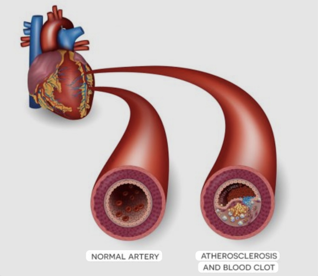 A Whisper In The Blood