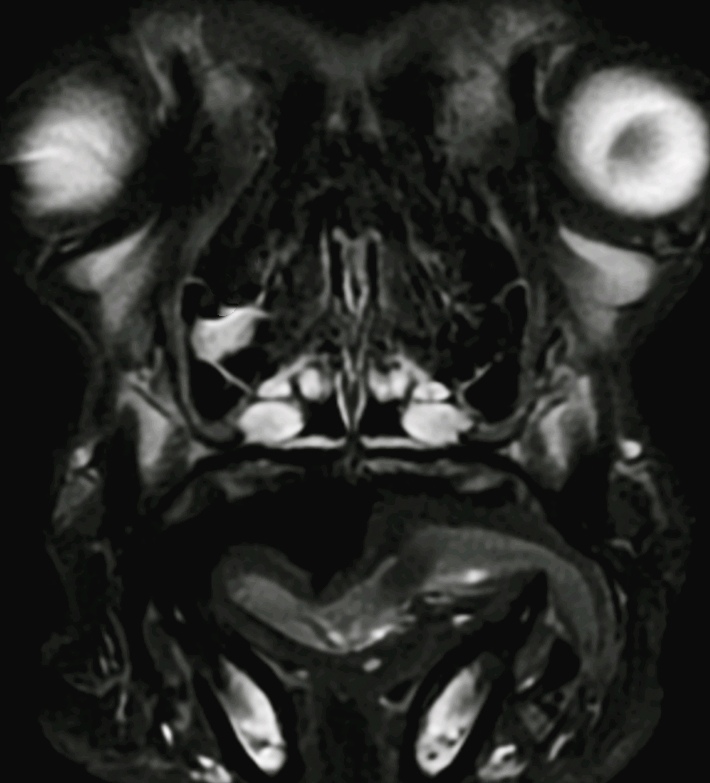 Είχα Μια Ιδέα;