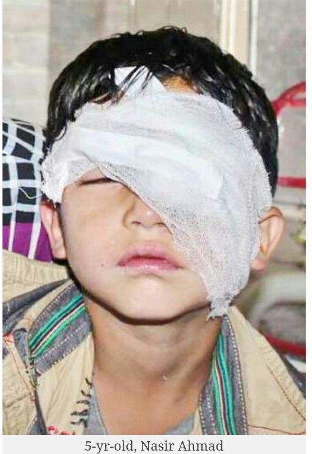 Eyes (About Kashmir)
